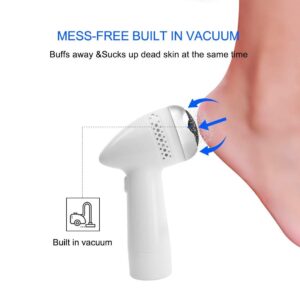 Foot Polisher - Remove Dead Skin & Calluses Fast