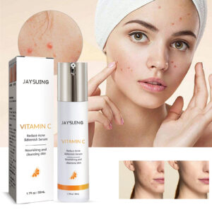 Clear Skin Serum: Reduce Acne & Marks with Moisture
