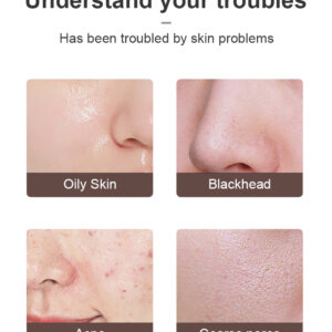 Facial Scrubber for Deep Cleansing & Smooth Skin