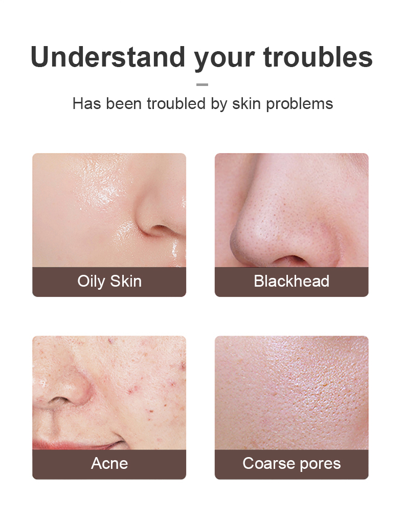 f62ab5ae f51c 4914 a39e c5c958c21d09.jpg Facial Scrubber for Deep Cleansing & Smooth Skin